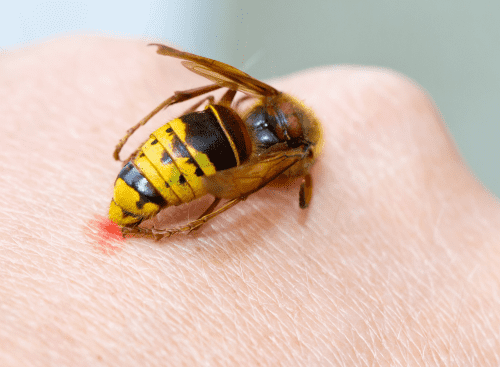 wasp stinging a human hand